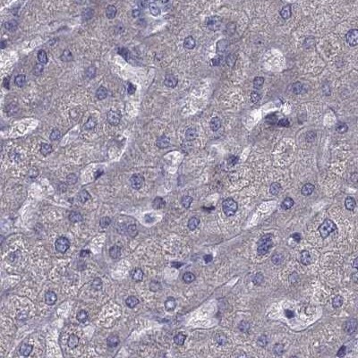 IKIP Antibody - BSA Free Immunohistochemistry-Paraffin: IKIP Antibody [NBP2-58695]