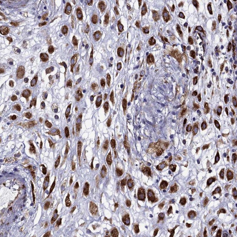 IKIP Antibody - BSA Free Immunohistochemistry-Paraffin: IKIP Antibody [NBP2-58695]