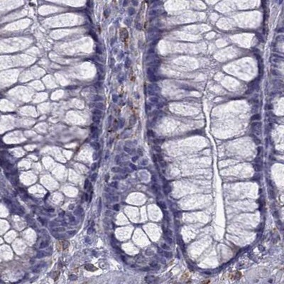 IKIP Antibody - BSA Free Immunohistochemistry-Paraffin: IKIP Antibody [NBP2-58695]