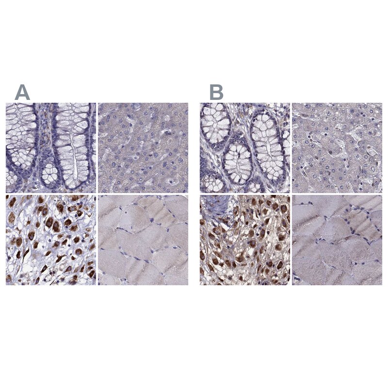 IKIP Antibody - BSA Free Immunohistochemistry-Paraffin: IKIP Antibody [NBP2-58695]