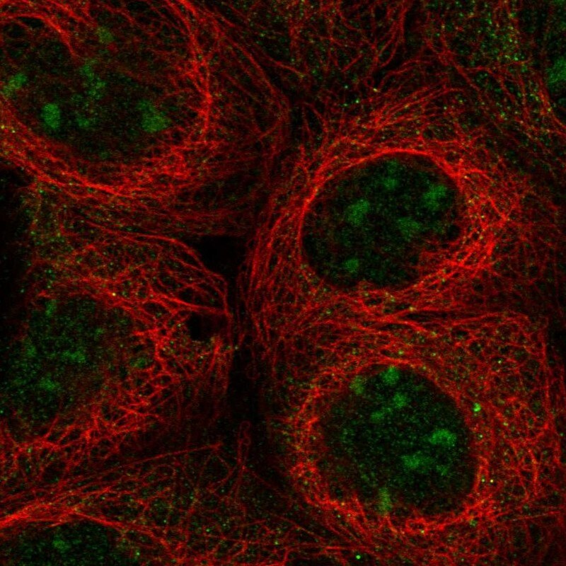 UBXD5 Antibody - BSA Free Immunocytochemistry/ Immunofluorescence: UBXD5 Antibody [NBP2-58719]