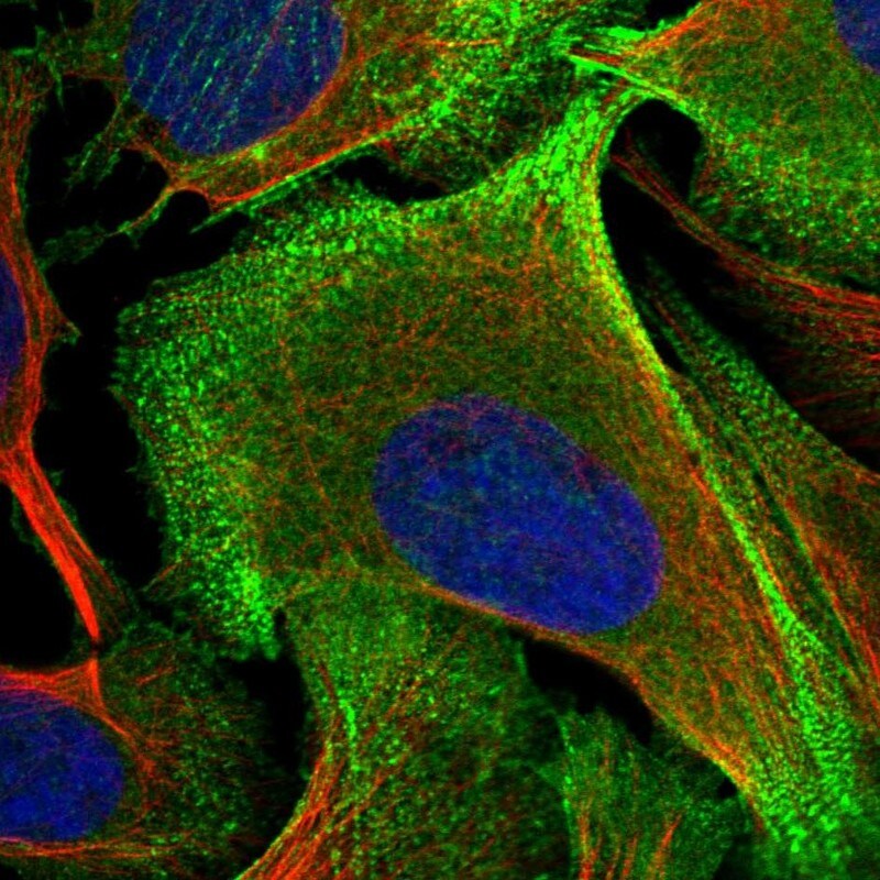 Palladin Antibody - BSA Free Immunocytochemistry/ Immunofluorescence: Palladin Antibody [NBP2-58731]