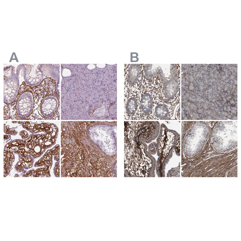 Collagen VI alpha 2 Antibody - BSA Free Immunohistochemistry: Collagen VI alpha 2 Antibody - BSA Free [NBP2-58879]