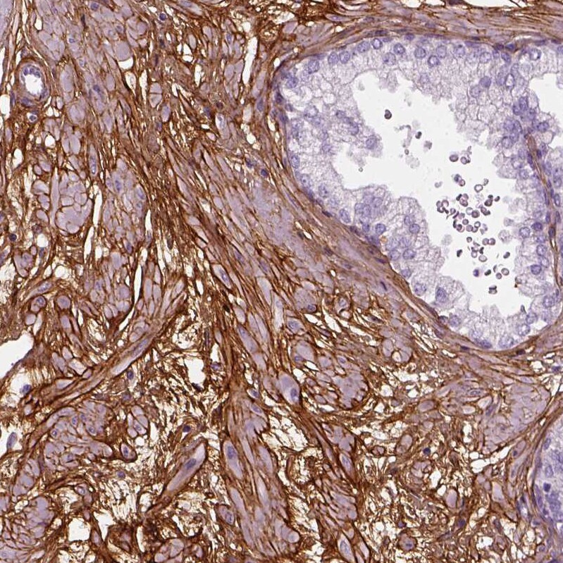 Collagen VI alpha 2 Antibody - BSA Free Immunohistochemistry: Collagen VI alpha 2 Antibody - BSA Free [NBP2-58879]
