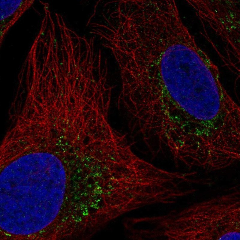 HTRA2/Omi Antibody - BSA Free Immunocytochemistry/ Immunofluorescence: HTRA2/Omi Antibody - BSA Free [NBP2-58890]