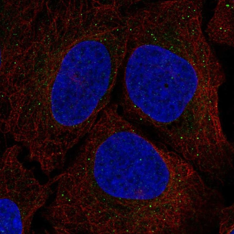 Serine racemase Antibody - BSA Free Immunocytochemistry/ Immunofluorescence: Serine racemase Antibody - BSA Free [NBP2-58903]