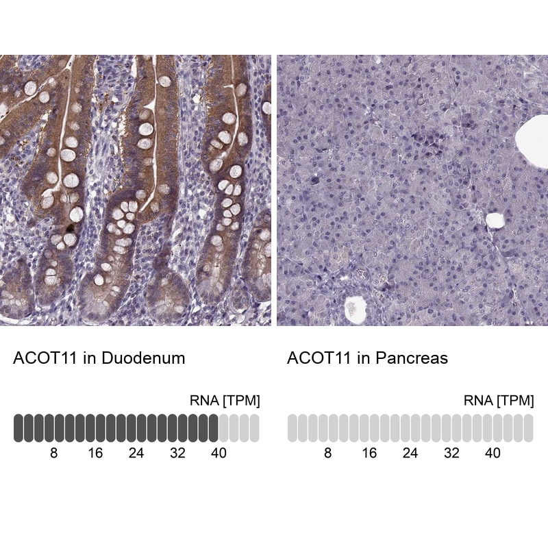 ACOT11 Antibody - BSA Free Immunohistochemistry-Paraffin: ACOT11 Antibody [NBP2-58936]