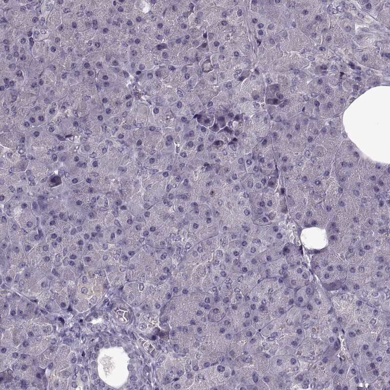 ACOT11 Antibody - BSA Free Immunohistochemistry-Paraffin: ACOT11 Antibody [NBP2-58936]