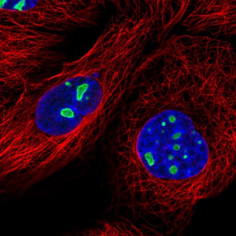 DDX18 Antibody - BSA Free Immunocytochemistry/ Immunofluorescence: DDX18 Antibody [NBP2-58939]