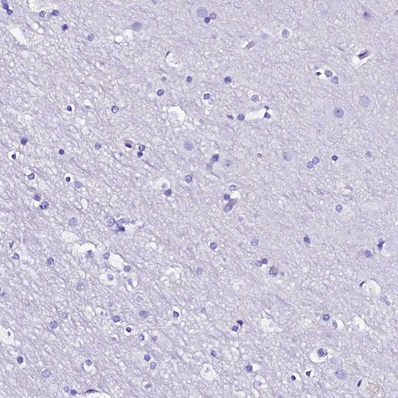 RBP3 Antibody - BSA Free Immunohistochemistry: RBP3 Antibody - BSA Free [NBP2-58952]