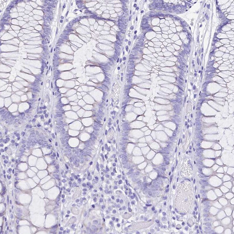 RBP3 Antibody - BSA Free Immunohistochemistry: RBP3 Antibody - BSA Free [NBP2-58952]