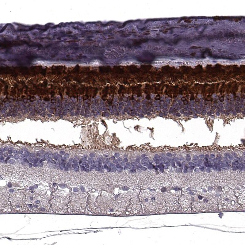 RBP3 Antibody - BSA Free Immunohistochemistry: RBP3 Antibody - BSA Free [NBP2-58952]