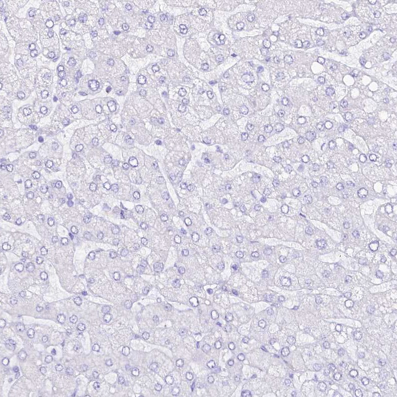 RBP3 Antibody - BSA Free Immunohistochemistry: RBP3 Antibody - BSA Free [NBP2-58952]