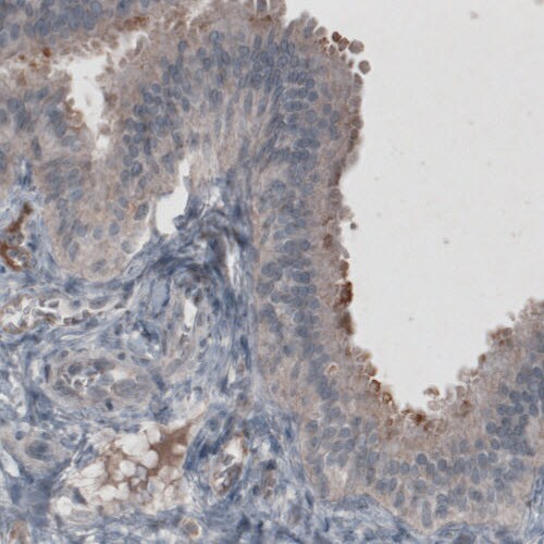 CA125/MUC16 Antibody (CL2783) - BSA Free Immunohistochemistry: CA125/MUC16 Antibody (CL2783) - BSA Free [NBP2-59024]