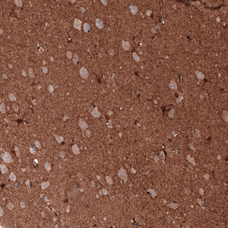 GAPDH Antibody (CL3265) - BSA Free Immunohistochemistry: GAPDH Antibody (CL3265) [NBP3-52489]