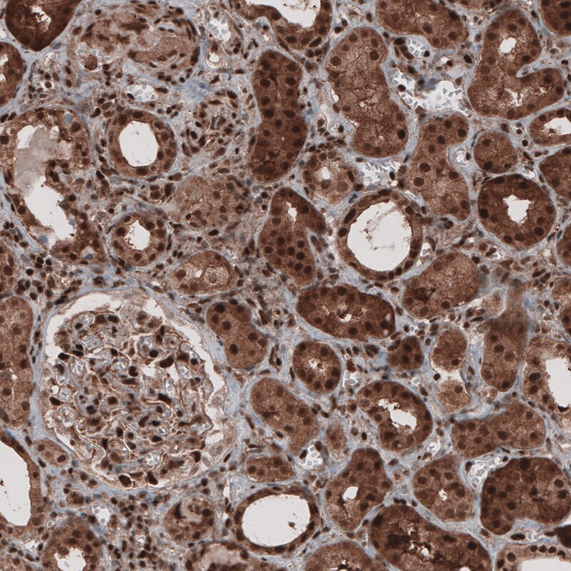 GAPDH Antibody (CL3265) - BSA Free Immunohistochemistry: GAPDH Antibody (CL3265) [NBP3-52489]