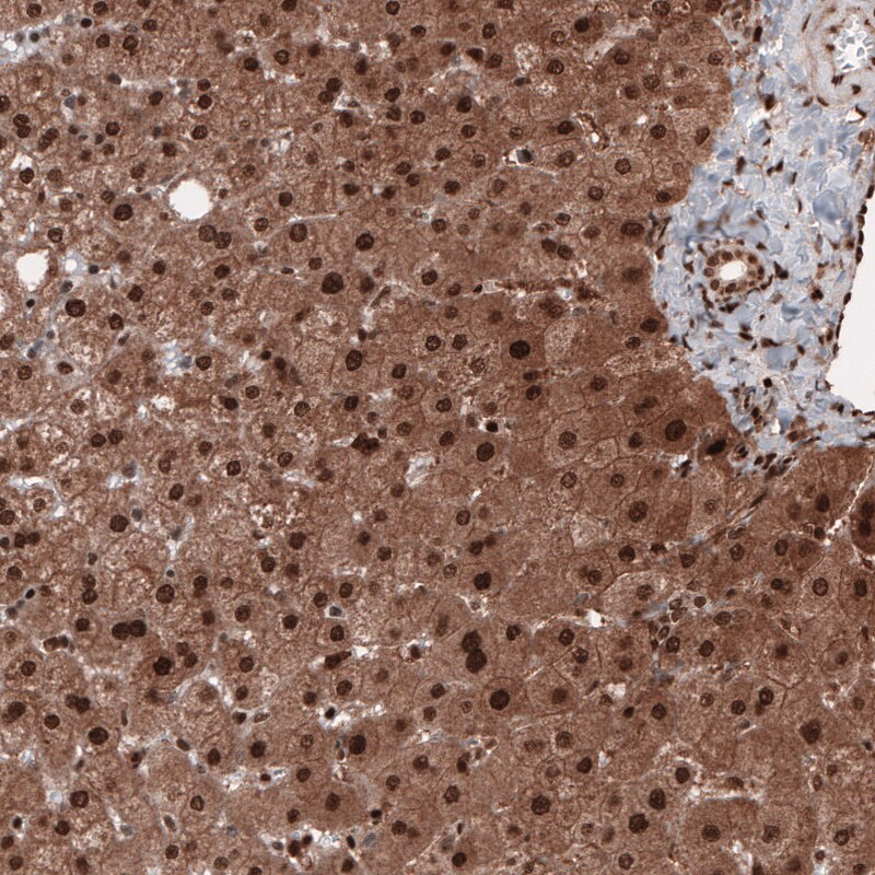 GAPDH Antibody (CL3265) - BSA Free Immunohistochemistry: GAPDH Antibody (CL3265) [NBP3-52489]