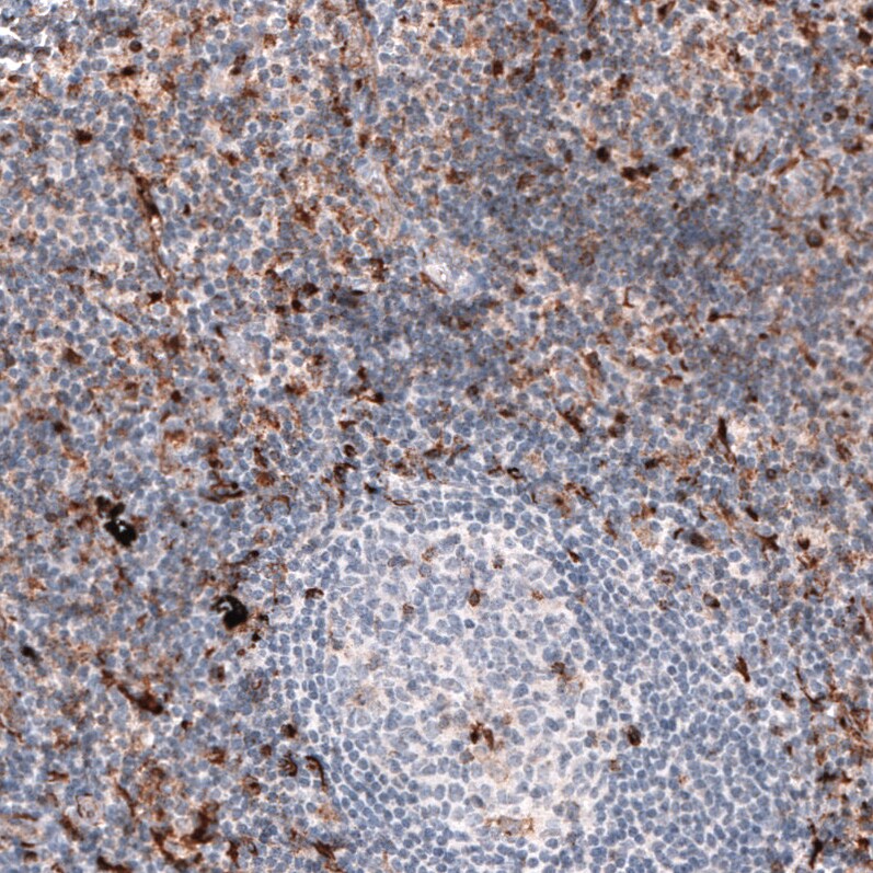 VISTA/B7-H5/PD-1H Antibody (CL3975) - BSA Free Immunohistochemistry: VISTA/B7-H5/PD-1H Antibody (CL3975) [NBP3-52473]