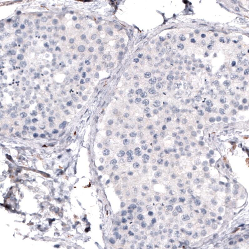 VISTA/B7-H5/PD-1H Antibody (CL3975) - BSA Free Immunohistochemistry: VISTA/B7-H5/PD-1H Antibody (CL3975) [NBP3-52473]