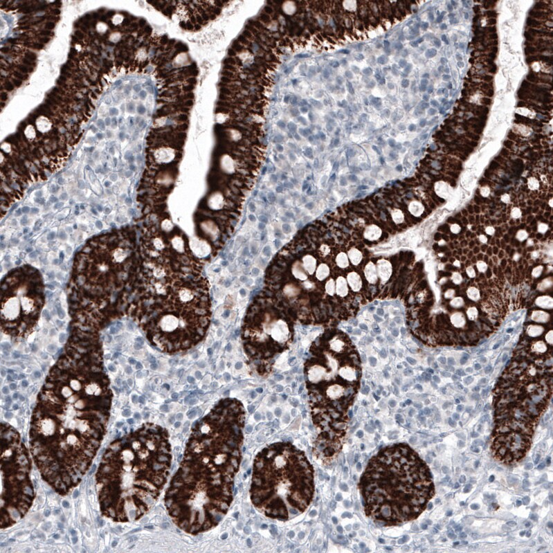 Ornithine Carbamoyltransferase Antibody (CL4045) - BSA Free Immunohistochemistry: Ornithine Carbamoyltransferase Antibody (CL4045) [NBP3-52475]