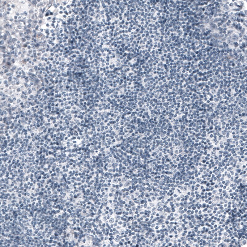 Ornithine Carbamoyltransferase Antibody (CL4045) - BSA Free Immunohistochemistry: Ornithine Carbamoyltransferase Antibody (CL4045) [NBP3-52475]