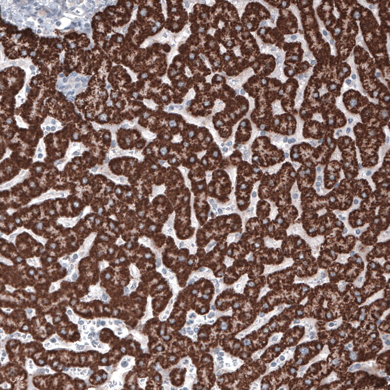 Ornithine Carbamoyltransferase Antibody (CL4045) - BSA Free Immunohistochemistry: Ornithine Carbamoyltransferase Antibody (CL4045) [NBP3-52475]