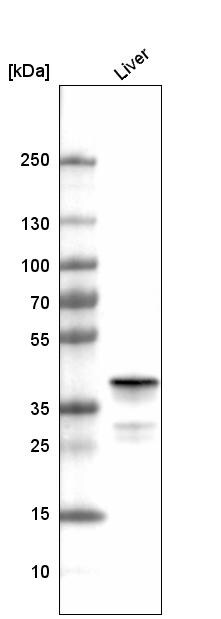 Ornithine Carbamoyltransferase Antibody (CL4045) - BSA Free Western Blot: Ornithine Carbamoyltransferase Antibody (CL4045) [NBP3-52475]