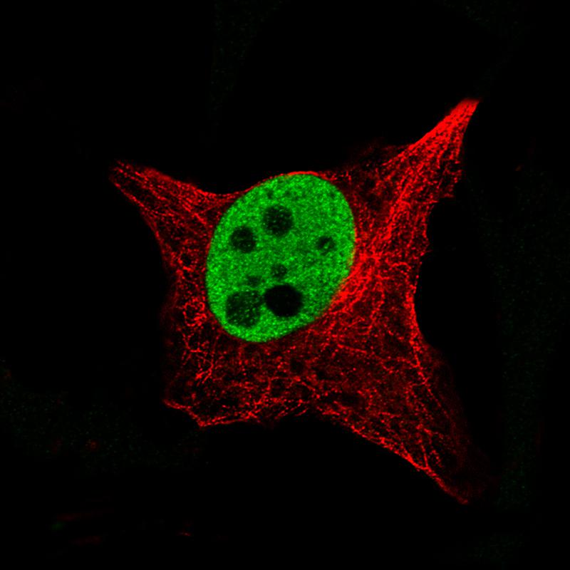 SOX10 Antibody (CL4455) - BSA Free Immunocytochemistry/ Immunofluorescence: SOX10 Antibody (CL4455) [NBP2-59050]