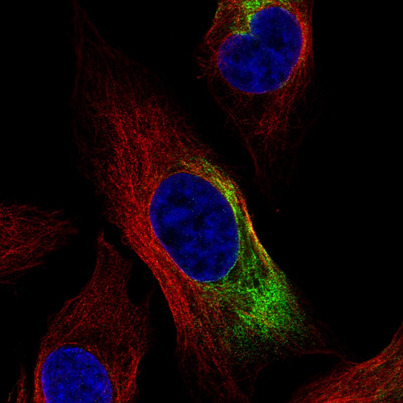 NF-L Antibody (CL4729) - BSA Free Immunocytochemistry/ Immunofluorescence: NF-L Antibody (CL4729) [NBP2-59061]