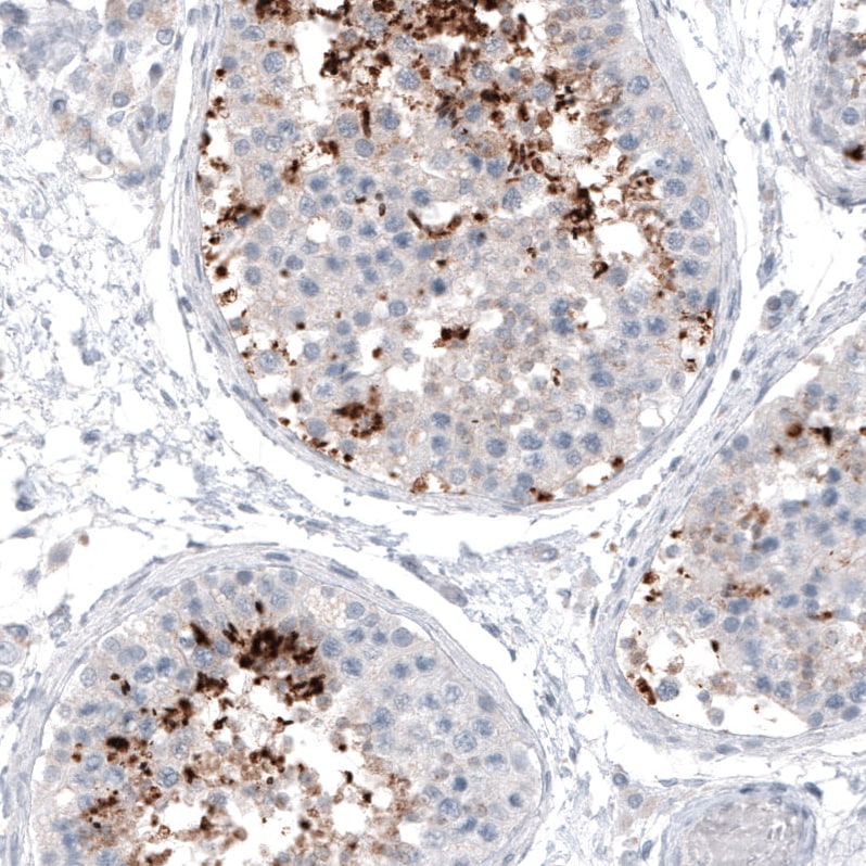 CT83 Antibody (CL4762) - BSA Free Immunohistochemistry: CT83 Antibody (CL4762) [NBP3-52476]