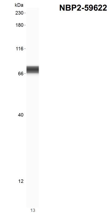 SOX10 Antibody (SOX10/1074)