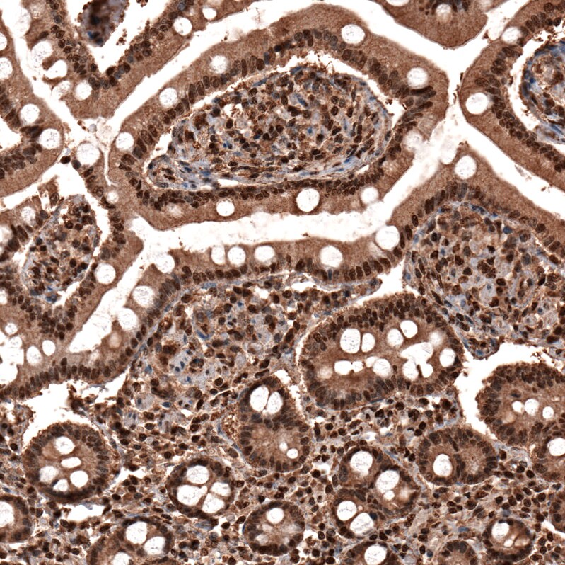 GAPDH Antibody (CL3266) - BSA Free Immunohistochemistry-Paraffin: GAPDH Antibody (CL3266) [NBP2-59779]