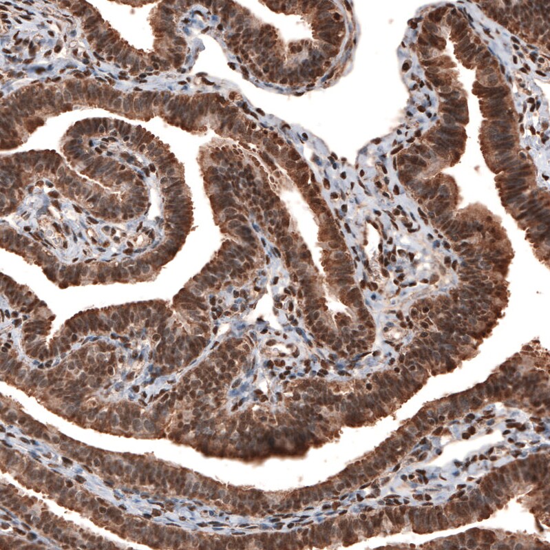 GAPDH Antibody (CL3266) - BSA Free Immunohistochemistry-Paraffin: GAPDH Antibody (CL3266) [NBP2-59779]