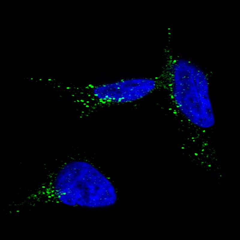 TYRP1 Antibody (CL4906) - BSA Free Immunocytochemistry/ Immunofluorescence: TYRP1 Antibody (CL4906) [NBP2-61142]