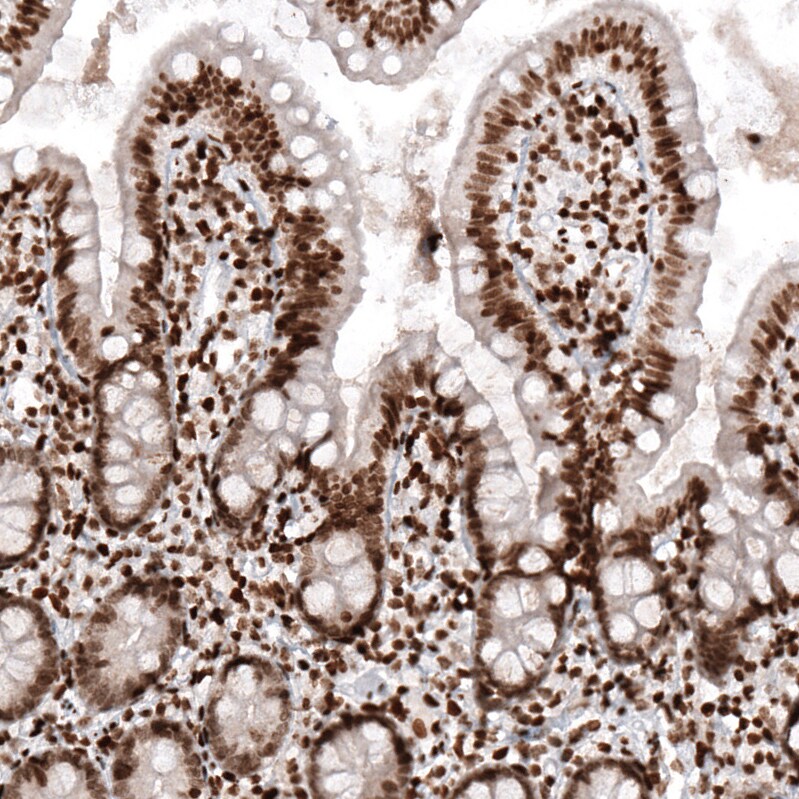 HIST1H2AG Antibody (CL5039) - BSA Free Immunohistochemistry-Paraffin: HIST1H2AG Antibody (CL5039) [NBP2-61151]