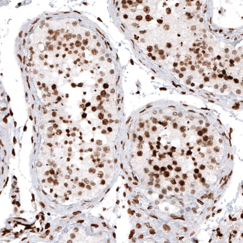 HIST1H2AG Antibody (CL5039) - BSA Free Immunohistochemistry-Paraffin: HIST1H2AG Antibody (CL5039) [NBP2-61151]