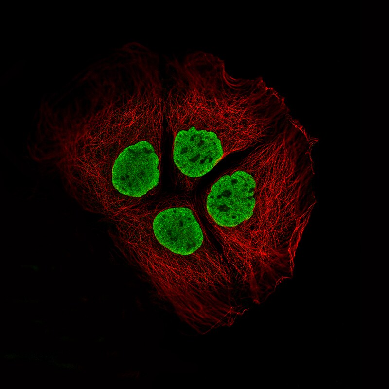 Histone H2AY/macroH2A.1 Antibody (CL5245) - BSA Free Immunocytochemistry/ Immunofluorescence: Histone H2AY/macroH2A.1 Antibody (CL5245) - BSA Free[NBP2-61155]