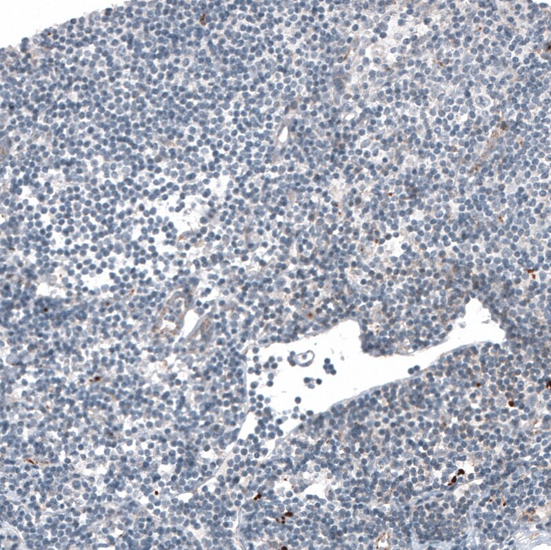 LAPTM4B Antibody (CL5289) - BSA Free Immunohistochemistry: LAPTM4B Antibody (CL5289) [NBP3-52478]