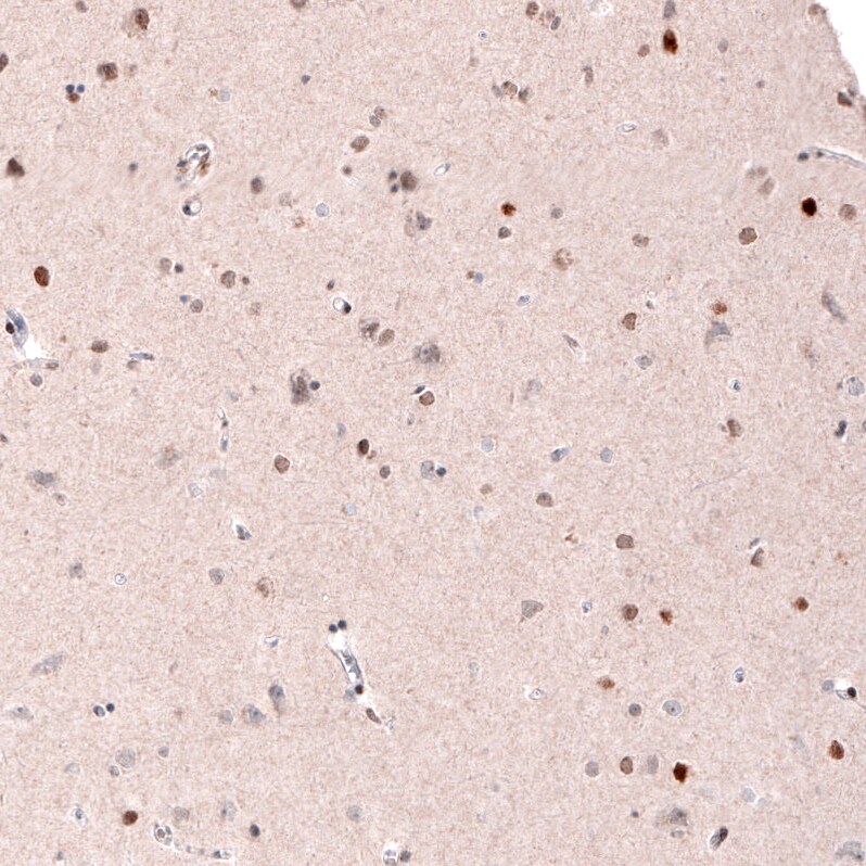 CDP/CUTL1 Antibody (CL5278) - BSA Free Immunohistochemistry: CDP/CUTL1 Antibody (CL5278) [NBP3-52477]