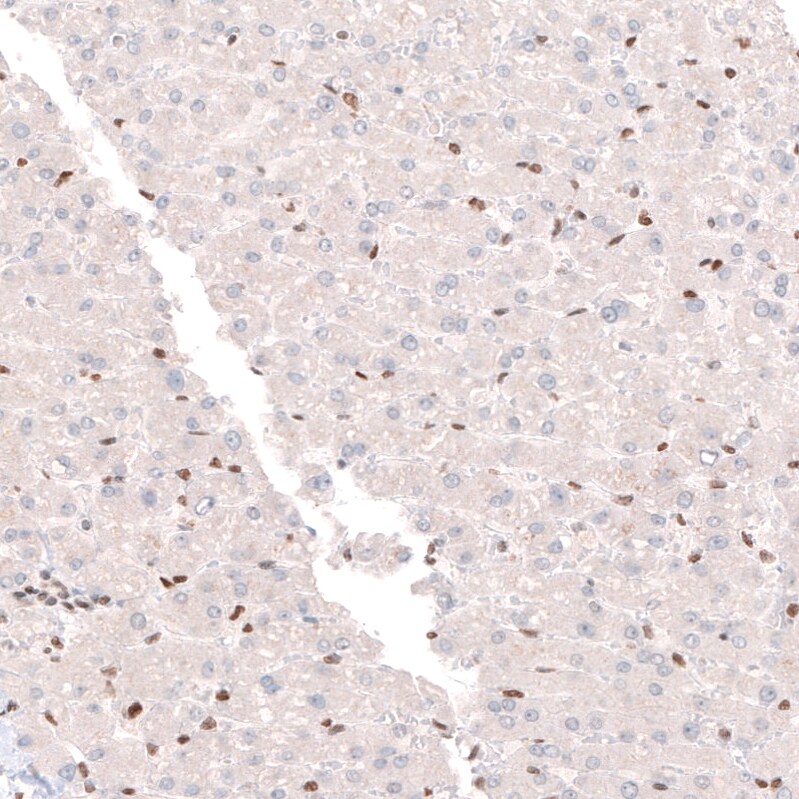 CDP/CUTL1 Antibody (CL5278) - BSA Free Immunohistochemistry: CDP/CUTL1 Antibody (CL5278) [NBP3-52477]