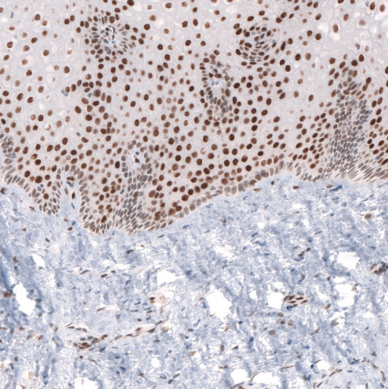 CDP/CUTL1 Antibody (CL5278) - BSA Free Immunohistochemistry: CDP/CUTL1 Antibody (CL5278) [NBP3-52477]