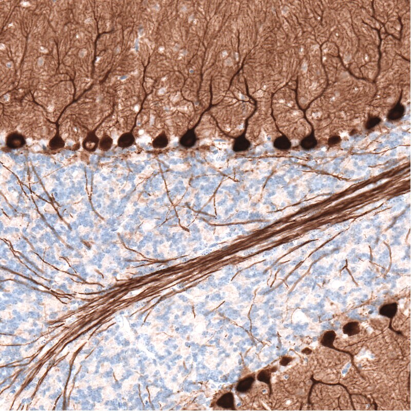 PCP4 Antibody (CL5306) - BSA Free Immunohistochemistry: PCP4 Antibody (CL5306) [NBP3-52479]