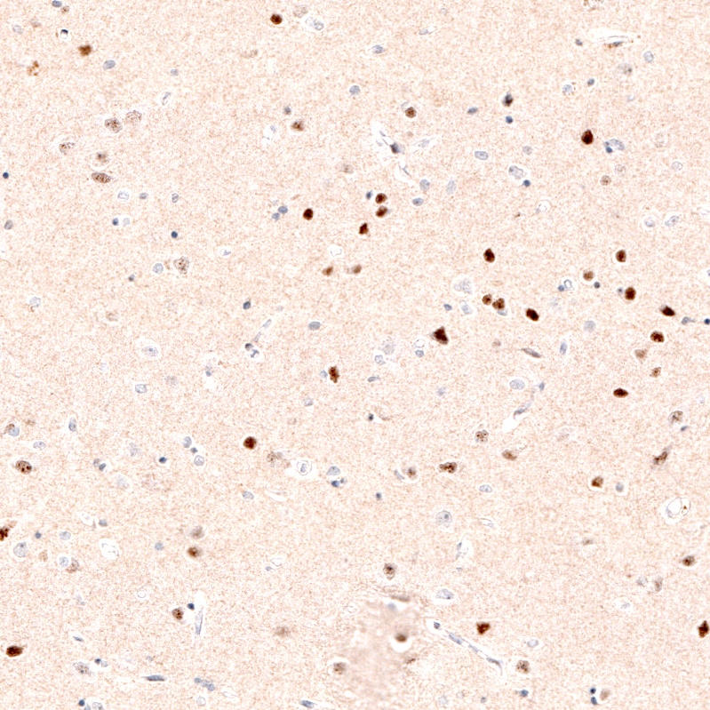 FoxP2 Antibody (CL5312) - BSA Free Immunohistochemistry: FoxP2 Antibody (CL5312) [NBP3-52480]