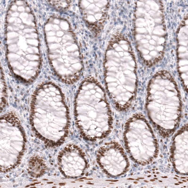 FoxP2 Antibody (CL5312) - BSA Free Immunohistochemistry: FoxP2 Antibody (CL5312) [NBP3-52480]