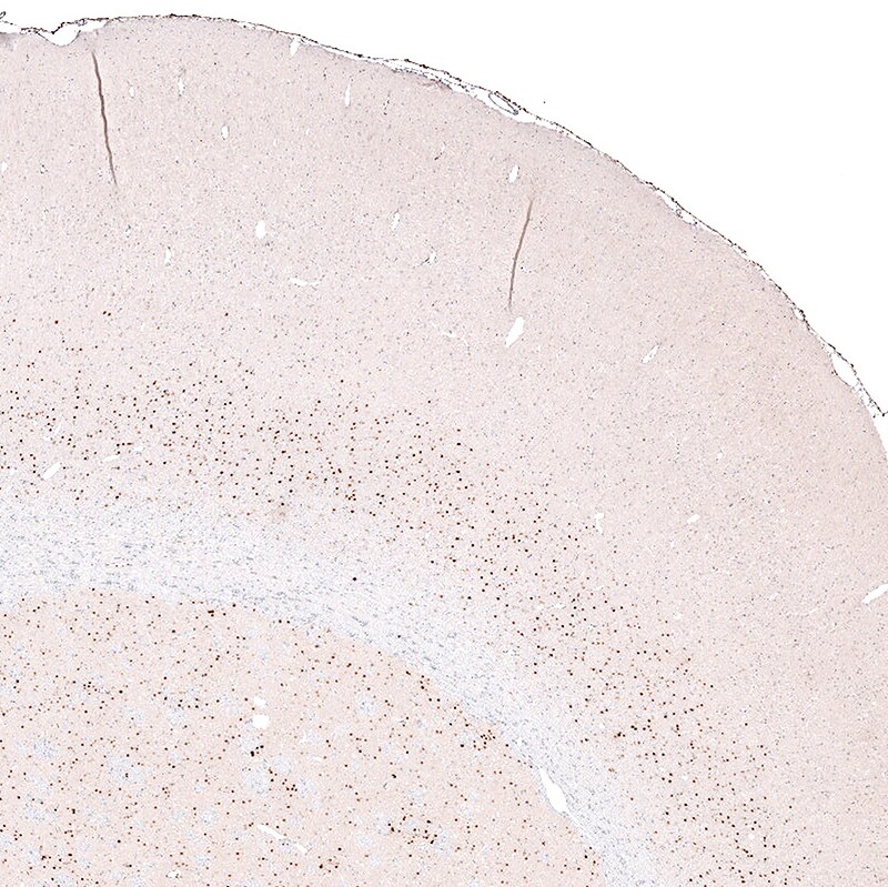 FoxP2 Antibody (CL5312) - BSA Free Immunohistochemistry: FoxP2 Antibody (CL5312) [NBP3-52480]