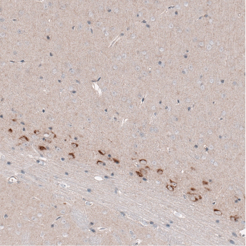 CTGF/CCN2 Antibody (CL5339) - BSA Free Immunohistochemistry-Paraffin: CTGF/CCN2 Antibody (CL5339) [NBP2-61415]