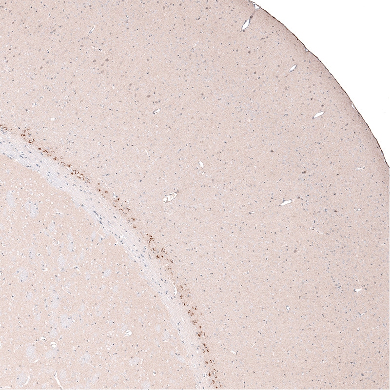 CTGF/CCN2 Antibody (CL5339) - BSA Free Immunohistochemistry-Paraffin: CTGF/CCN2 Antibody (CL5339) [NBP2-61415]