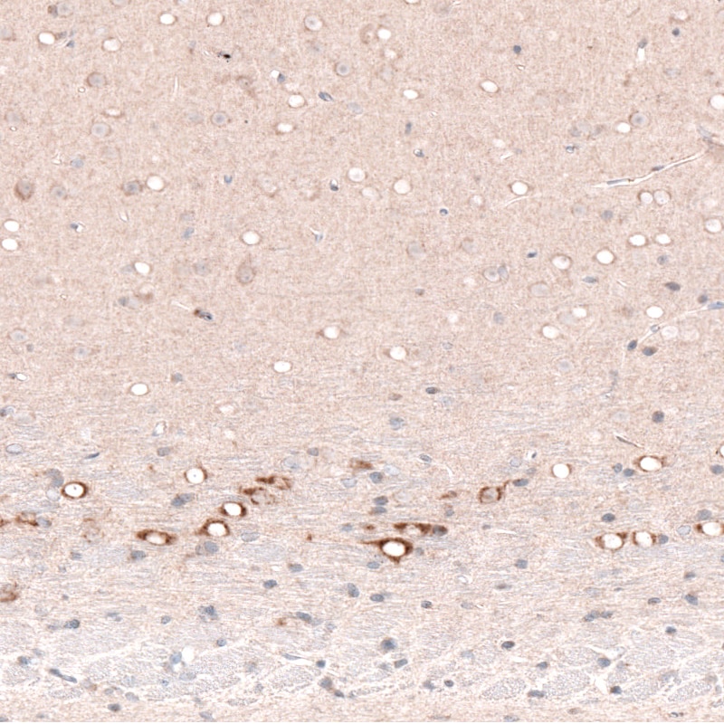 CTGF/CCN2 Antibody (CL5339) - BSA Free Immunohistochemistry-Paraffin: CTGF/CCN2 Antibody (CL5339) [NBP2-61415]