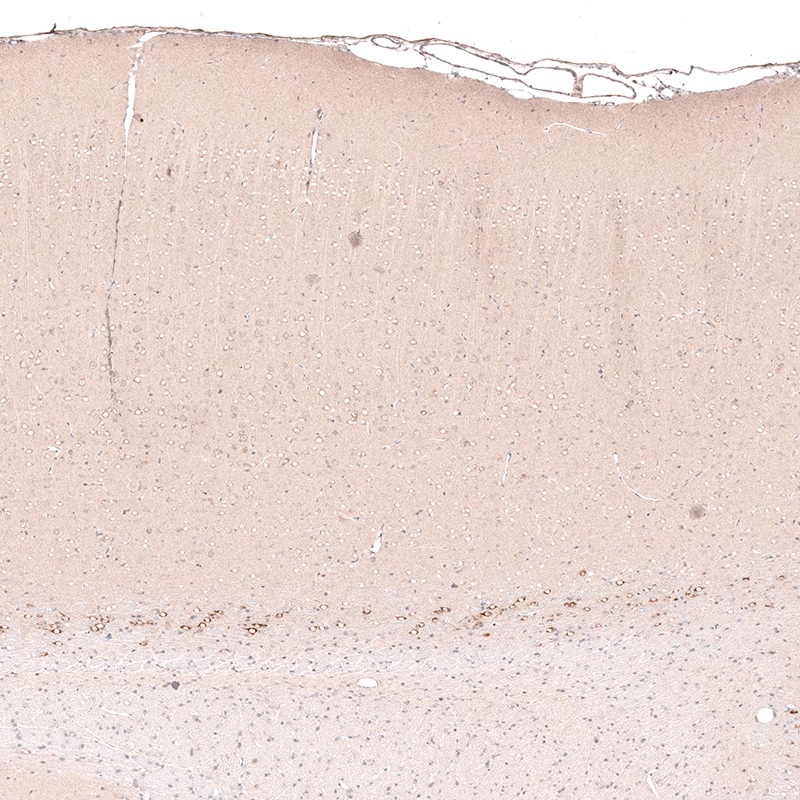 CTGF/CCN2 Antibody (CL5339) - BSA Free Immunohistochemistry-Paraffin: CTGF/CCN2 Antibody (CL5339) [NBP2-61415]