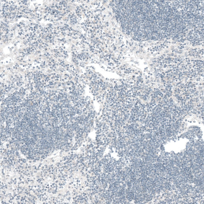 CTGF/CCN2 Antibody (CL5339) - BSA Free Immunohistochemistry-Paraffin: CTGF/CCN2 Antibody (CL5339) [NBP2-61415]